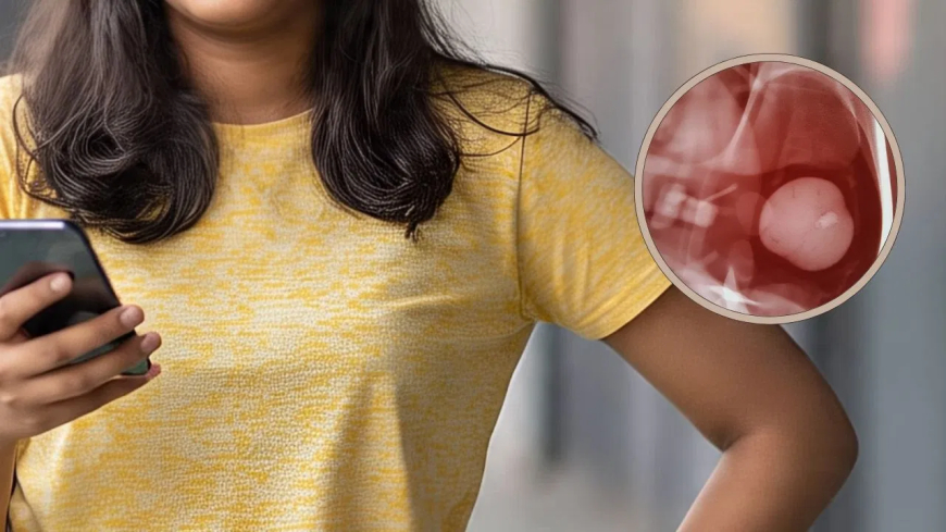 'तुम्हारी किडनी में पथरी है…' सुनकर डिप्रेशन में आई लड़की, फांसी लगाकर दे दी जान