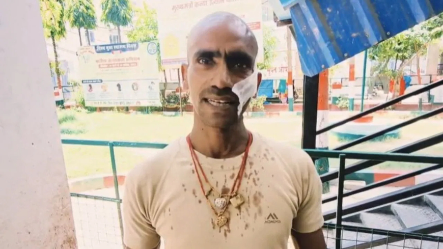 बेगूसराय: पत्नी की फोटो व्हाट्सएप स्टेटस पर देख भड़का पति, साढू और साले ने पीटा; अवैध संबंध का आरोप