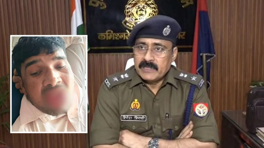 कानपुर में सनसनी: खेत में छेड़खानी करने पहुंचा था युवक, विरोध में युवती ने काटकर अलग कर दी जीभ